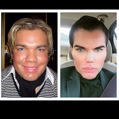Родриго Альвес до и после операций (фото из Instagram Альвеса)